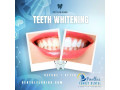 mouth-restoration-in-largo-fl-regain-a-healthy-confident-smile-small-0
