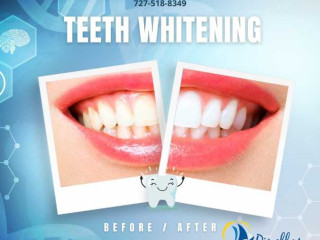 mouth-restoration-in-largo-fl-regain-a-healthy-confident-smile