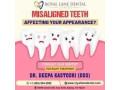 clear-aligners-in-dallas-invisible-aligners-near-me-small-0